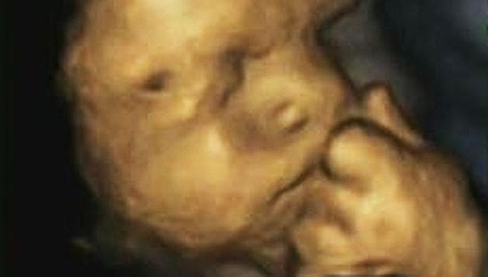 Ecografía 4D a las 34 semanas de gestación.