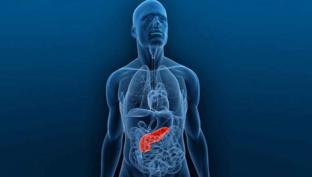 Cáncer de páncreas