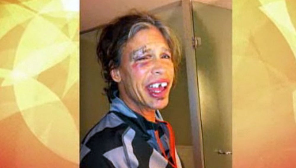 Así se le quedó la cara a Steven Tyler