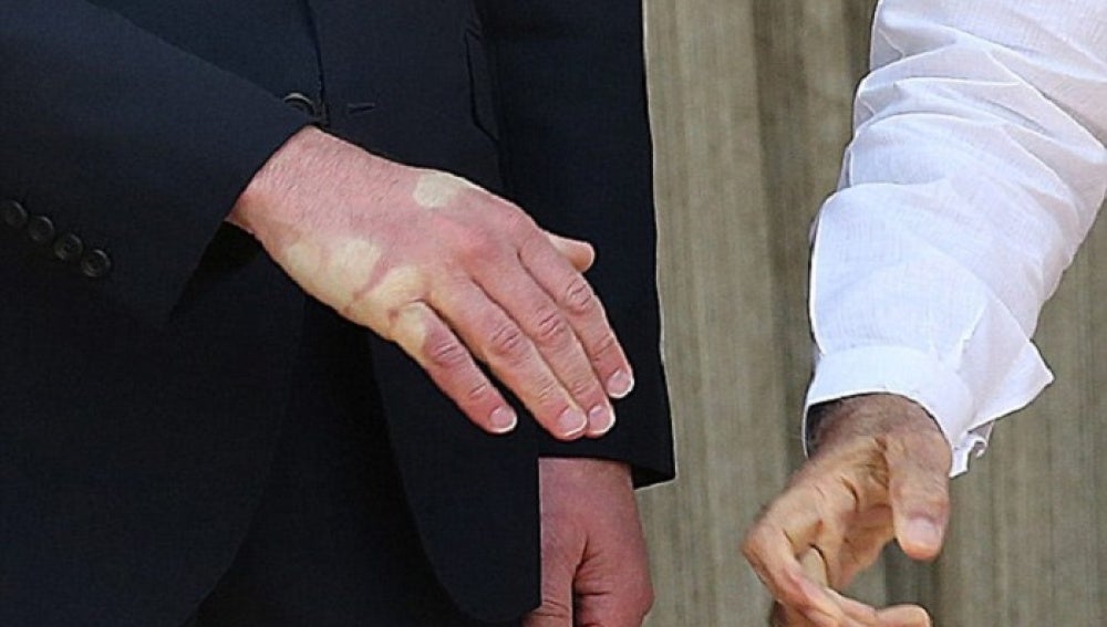 La mano del príncipe Gullermo tras el apretón de manos con Modi