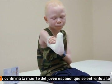Frame 28.790798 de: ALBINOS Frame 28.790798 de: ALBINOS