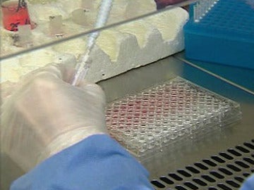 Contra el desarrollo del VIH Contra el desarrollo del VIH