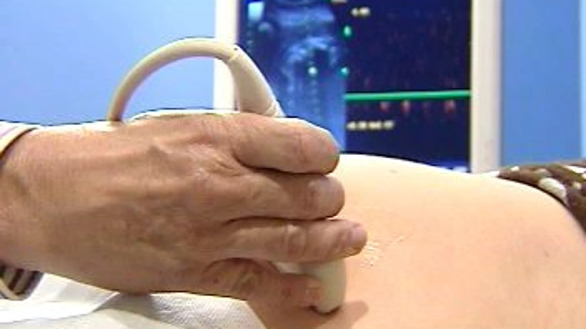 Reforma de la ley del aborto Reforma de la ley del aborto