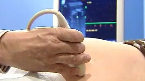 Reforma de la ley del aborto Reforma de la ley del aborto