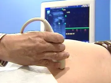 Reforma de la ley del aborto Reforma de la ley del aborto