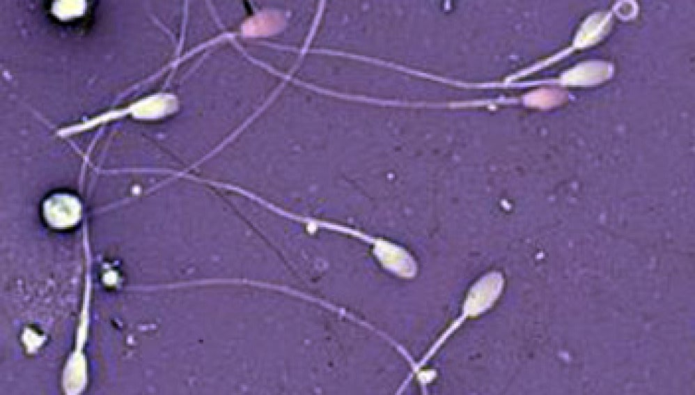 Crean un 'esperma de laboratorio'