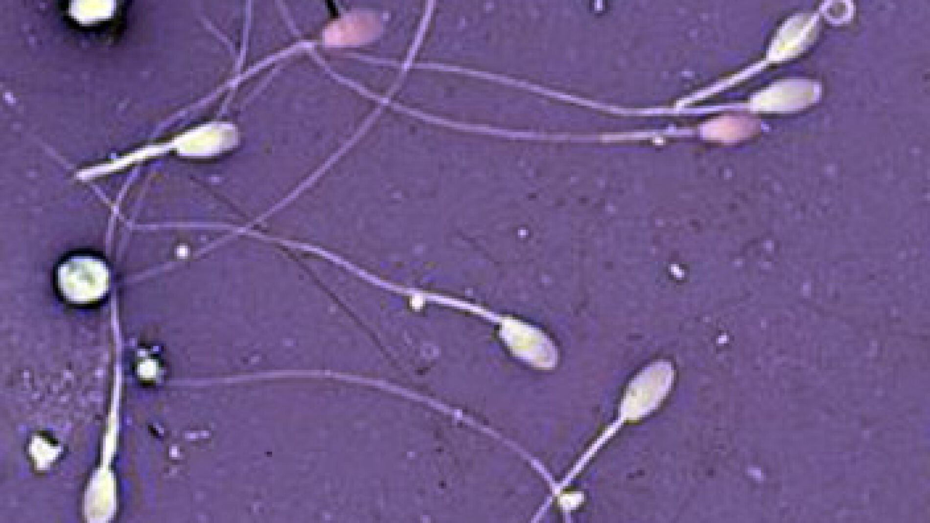 Crean un 'esperma de laboratorio'