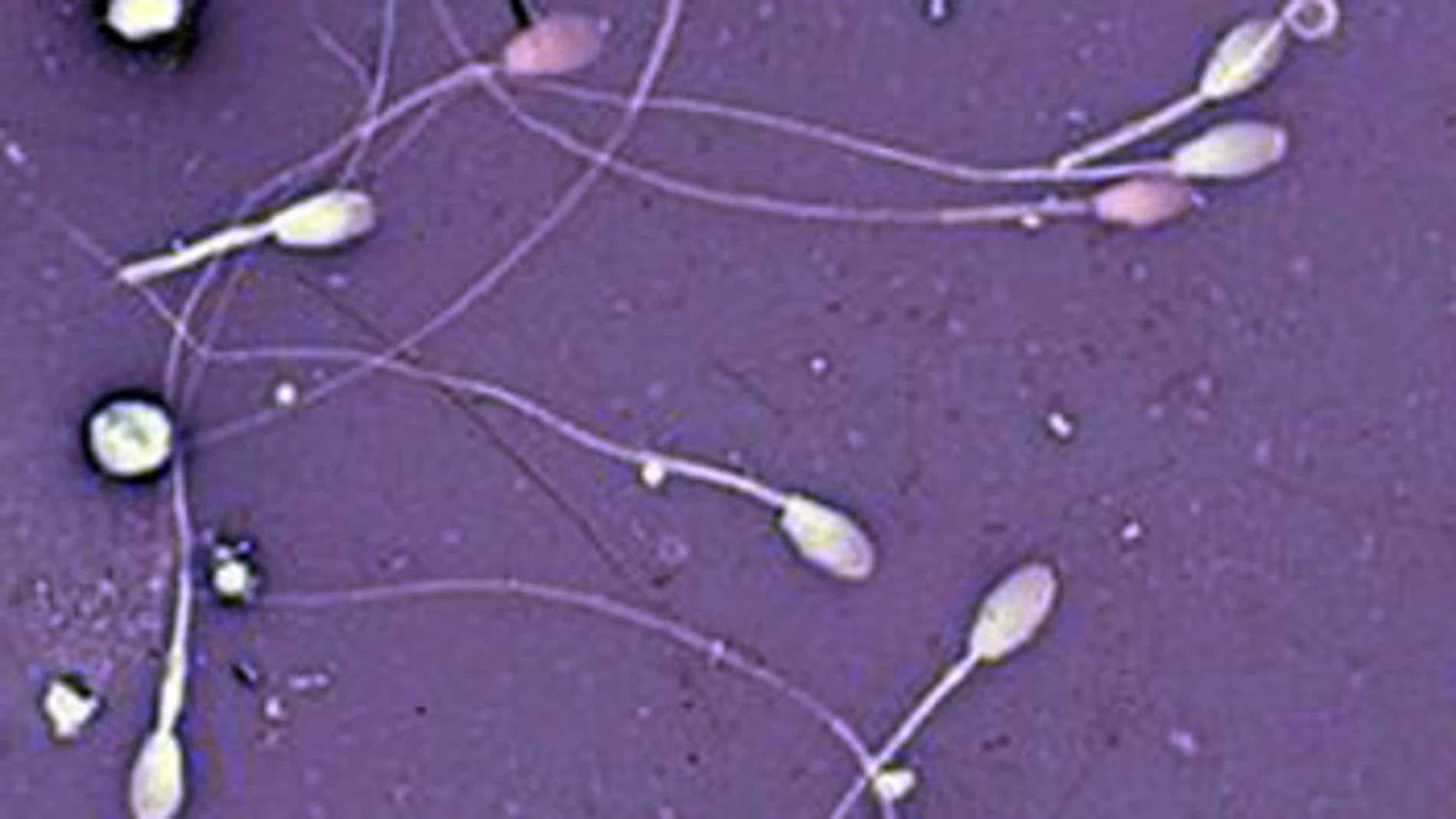 Crean un 'esperma de laboratorio' Crean un 'esperma de laboratorio'