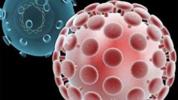 Células infectadas por el VIH
