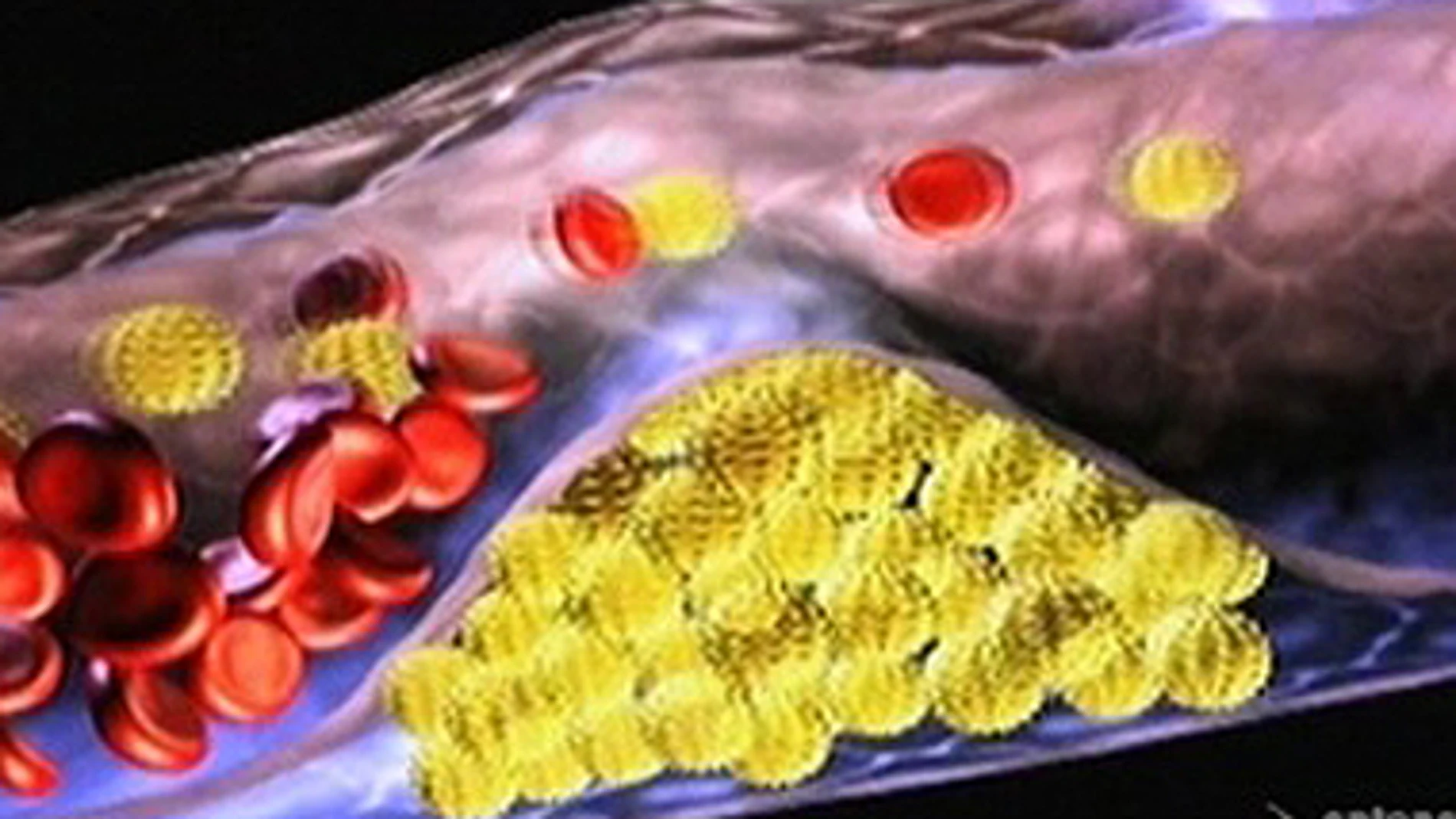 Colesterol Colesterol