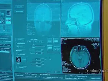 Un avance ciéntifico sobre el Alzheimer Un avance ciéntifico sobre el Alzheimer