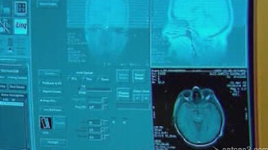 Un test permitirá detectar el alzheimer en la sangre