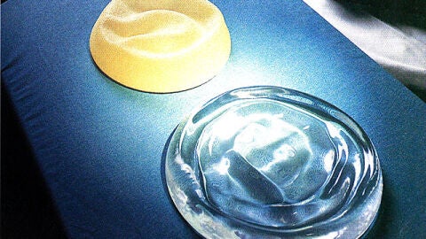 Pr&oacute;tesis mamarias