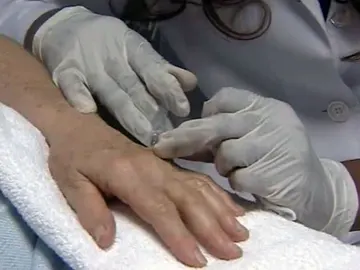 Tratamiento anti-edad en las manos Tratamiento anti-edad en las manos