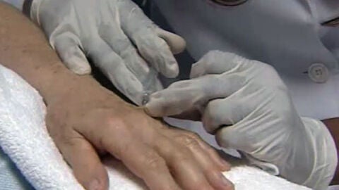 Tratamiento anti-edad en las manos