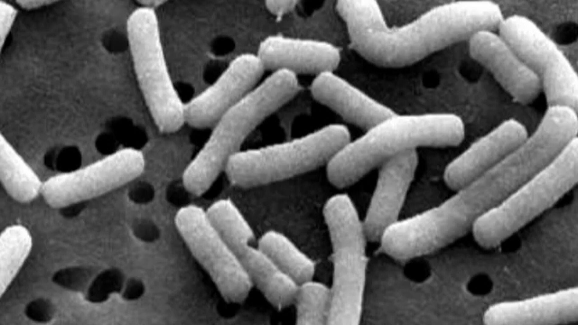 En el Centro de Investigaci&oacute;n D. Carasso de Par&iacute;s investigan las bacterias.