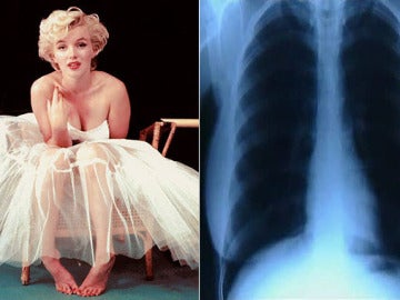 Los pulmones de Marilyn Monroe