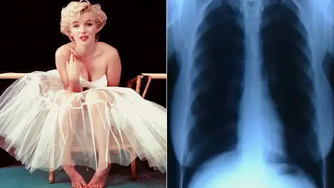 Los pulmones de Marilyn Monroe Los pulmones de Marilyn Monroe