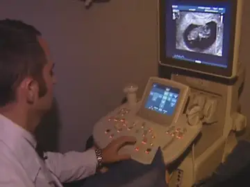 Ecografía en una clínica abortiva Ecografía en una clínica abortiva