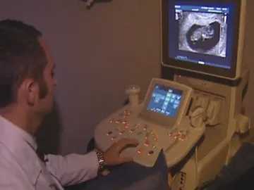 Ecografía en una clínica abortiva Ecografía en una clínica abortiva