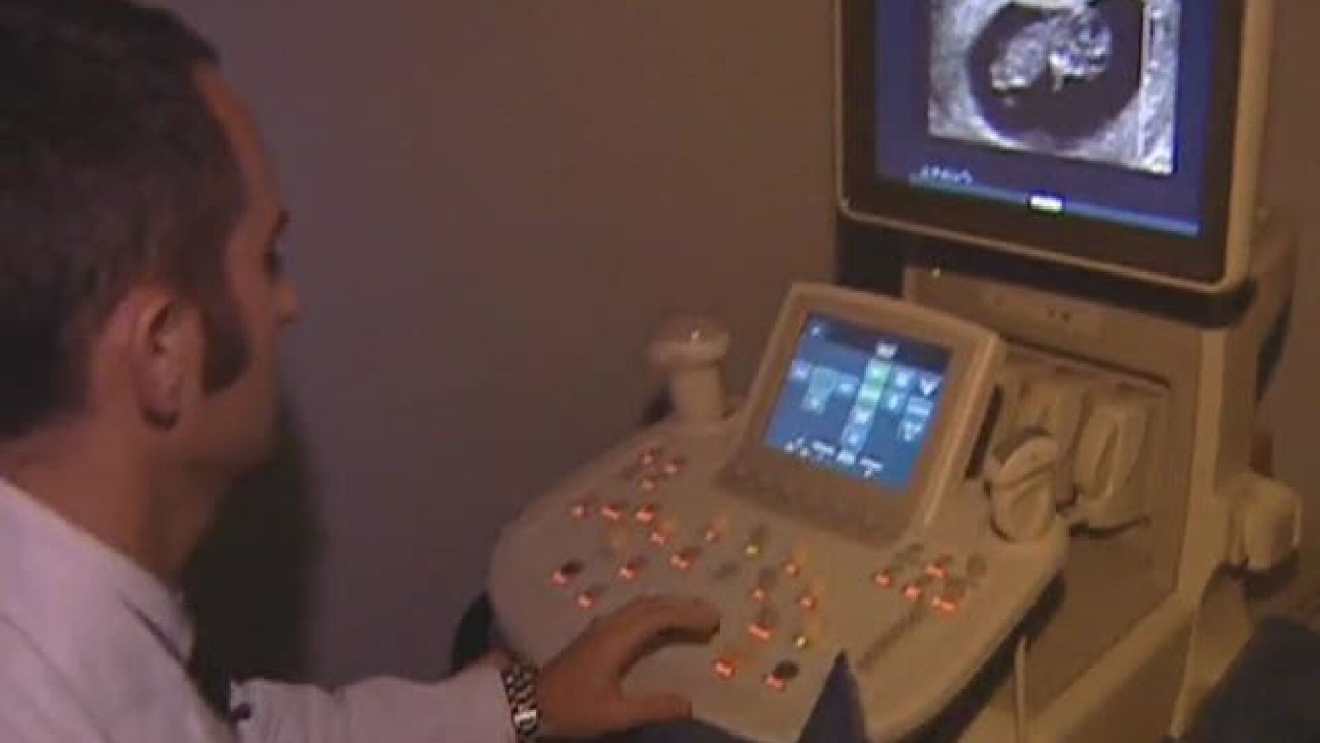 Ecograf&iacute;a en una cl&iacute;nica abortiva