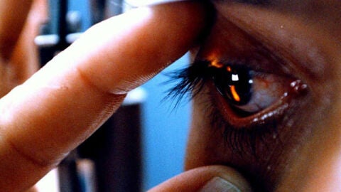 Corneas artificiales