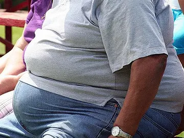 Un hombre obeso sentado en un banco Un hombre obeso sentado en un banco