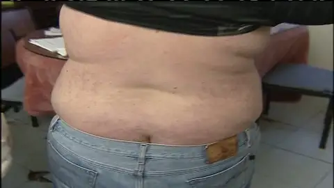 No dormir causa obesidad No dormir causa obesidad