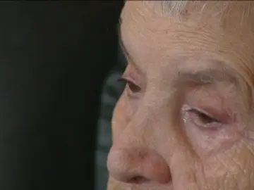Anciana con Alzheimer Anciana con Alzheimer