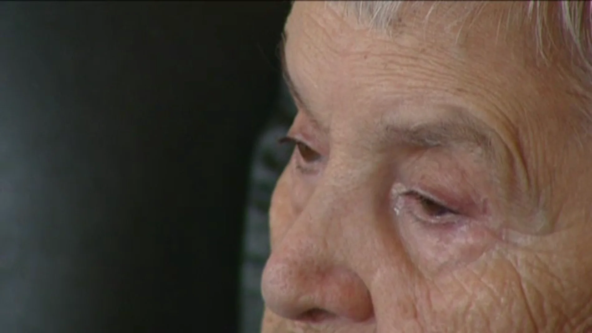 Anciana con Alzheimer Anciana con Alzheimer