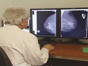 Esopecialista observando resultado de una mamografía