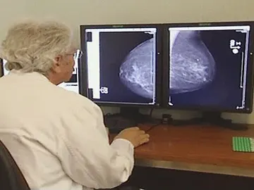 Esopecialista observando resultado de una mamografía Esopecialista observando resultado de una mamografía