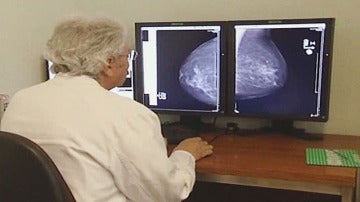 Esopecialista observando resultado de una mamografía