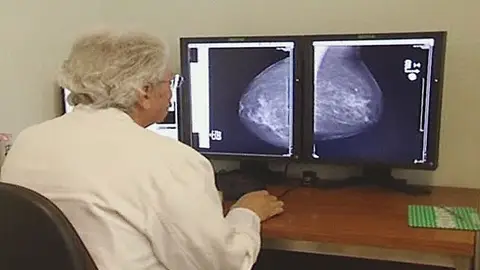 Esopecialista observando resultado de una mamografía Esopecialista observando resultado de una mamografía