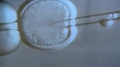 Tratamiento con células madre Tratamiento con células madre