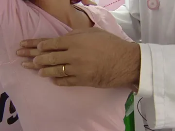 Exploración para prevenir el cáncer de mama Exploración para prevenir el cáncer de mama