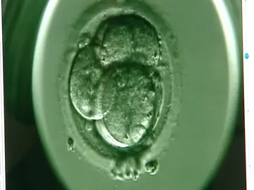 Imagen al detalle de un embrión recién creado Imagen al detalle de un embrión recién creado