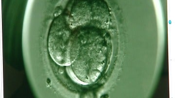Imagen al detalle de un embrión recién creado