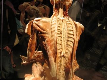 Un cuerpo disecado Un cuerpo disecado