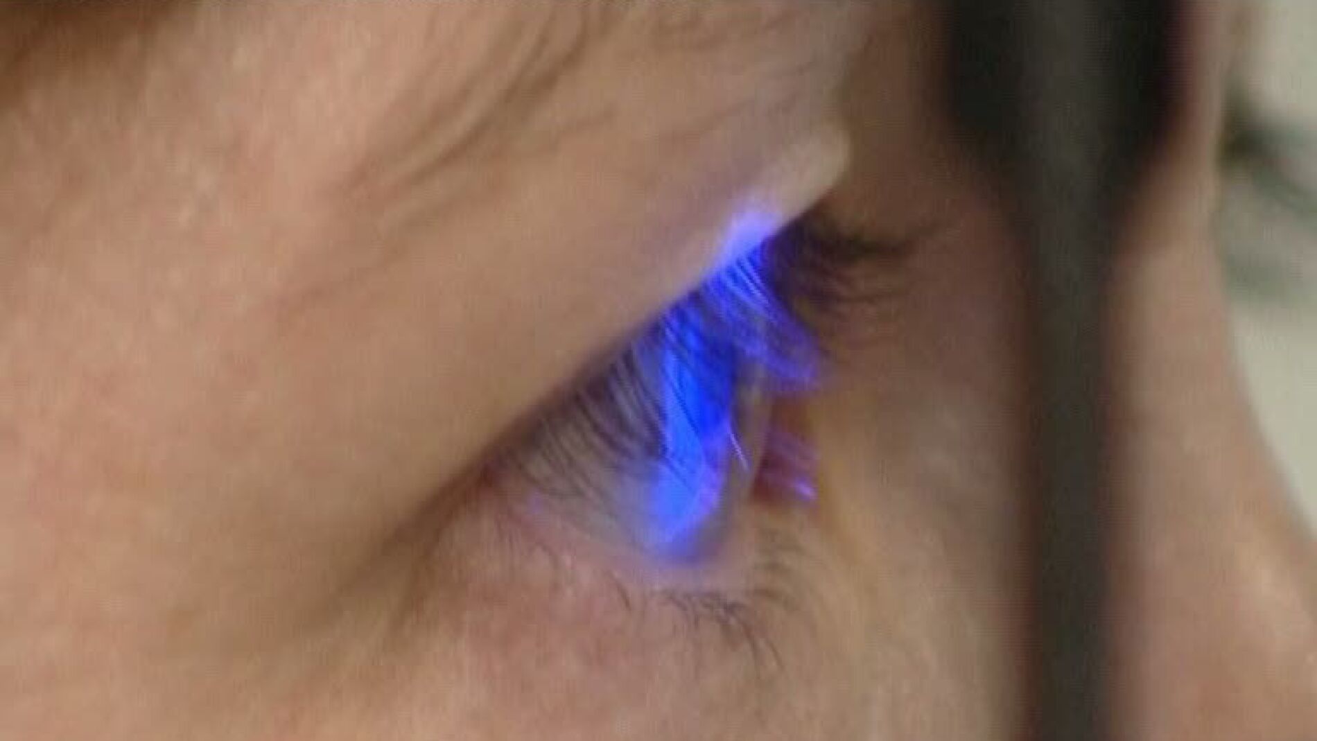 Estudio de la retina