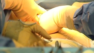 400 trasplantes de hígado con éxito en La Candelaria