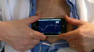 Una aplicación para iPhone permite realizar electrocardiogramas Una aplicación para iPhone permite realizar electrocardiogramas