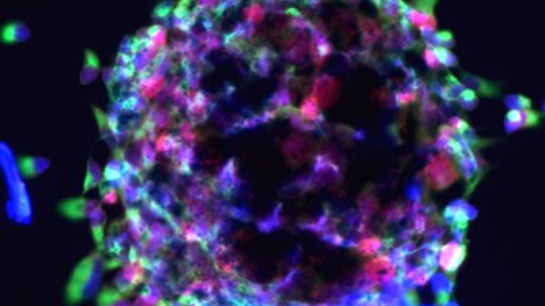 Desarrollan un modelo de c&eacute;lulas madre para estudiar la muerte s&uacute;bita cardiaca 