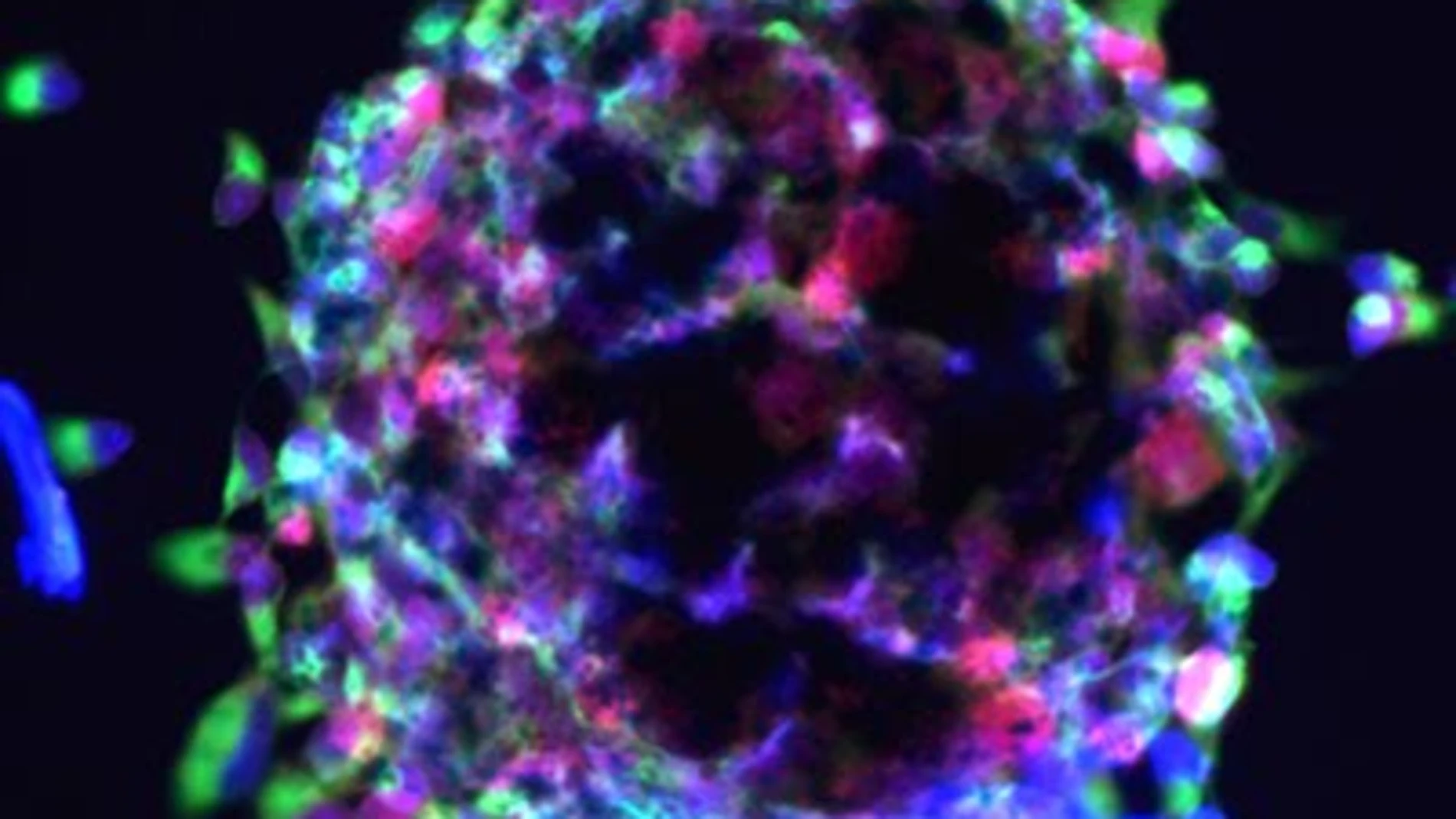 Desarrollan un modelo de células madre para estudiar la muerte súbita cardiaca Desarrollan un modelo de células madre para estudiar la muerte súbita cardiaca