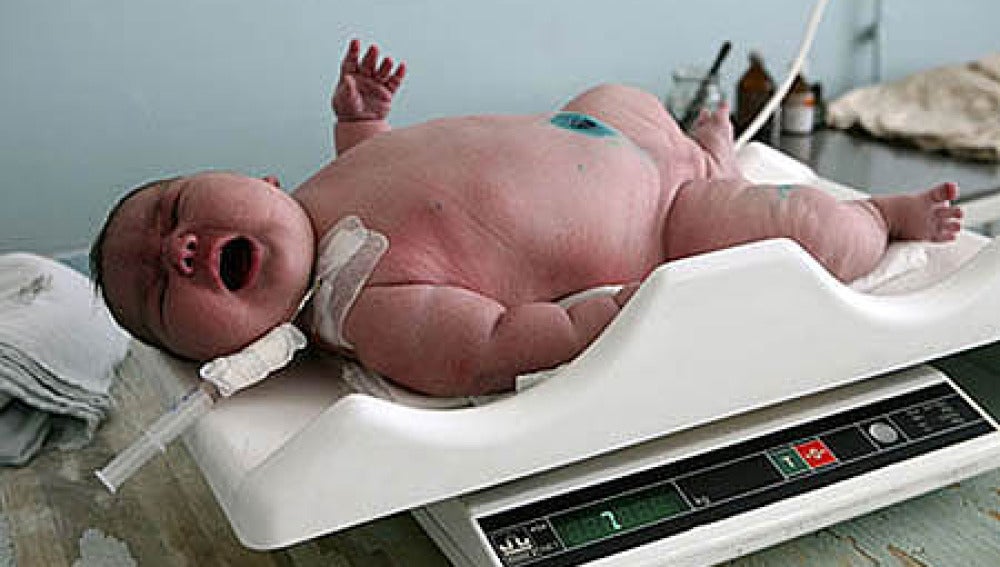 Nace Un Bebe Gigante En Rusia