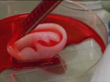 Una oreja reproducida por células madre
