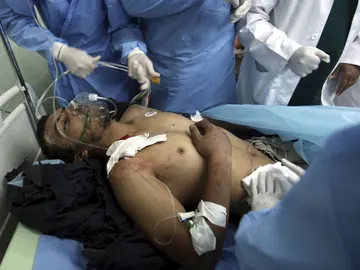 Un hombre recibe asistencia médica a su llegada al hospital de Ajdabiya, al este de Libia Un hombre recibe asistencia médica a su llegada al hospital de Ajdabiya, al este de Libia