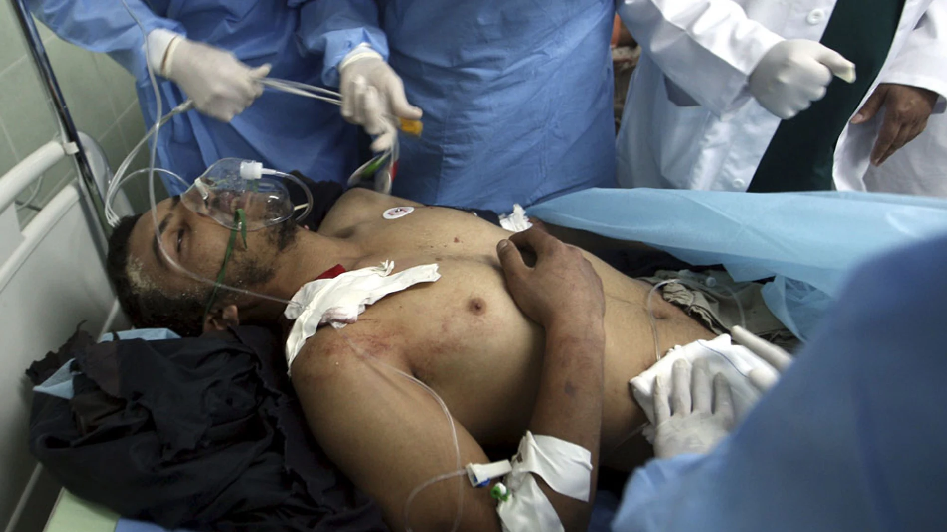 Un hombre recibe asistencia médica a su llegada al hospital de Ajdabiya, al este de Libia Un hombre recibe asistencia médica a su llegada al hospital de Ajdabiya, al este de Libia