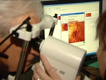 El glaucoma o la ceguera silenciosa El glaucoma o la ceguera silenciosa