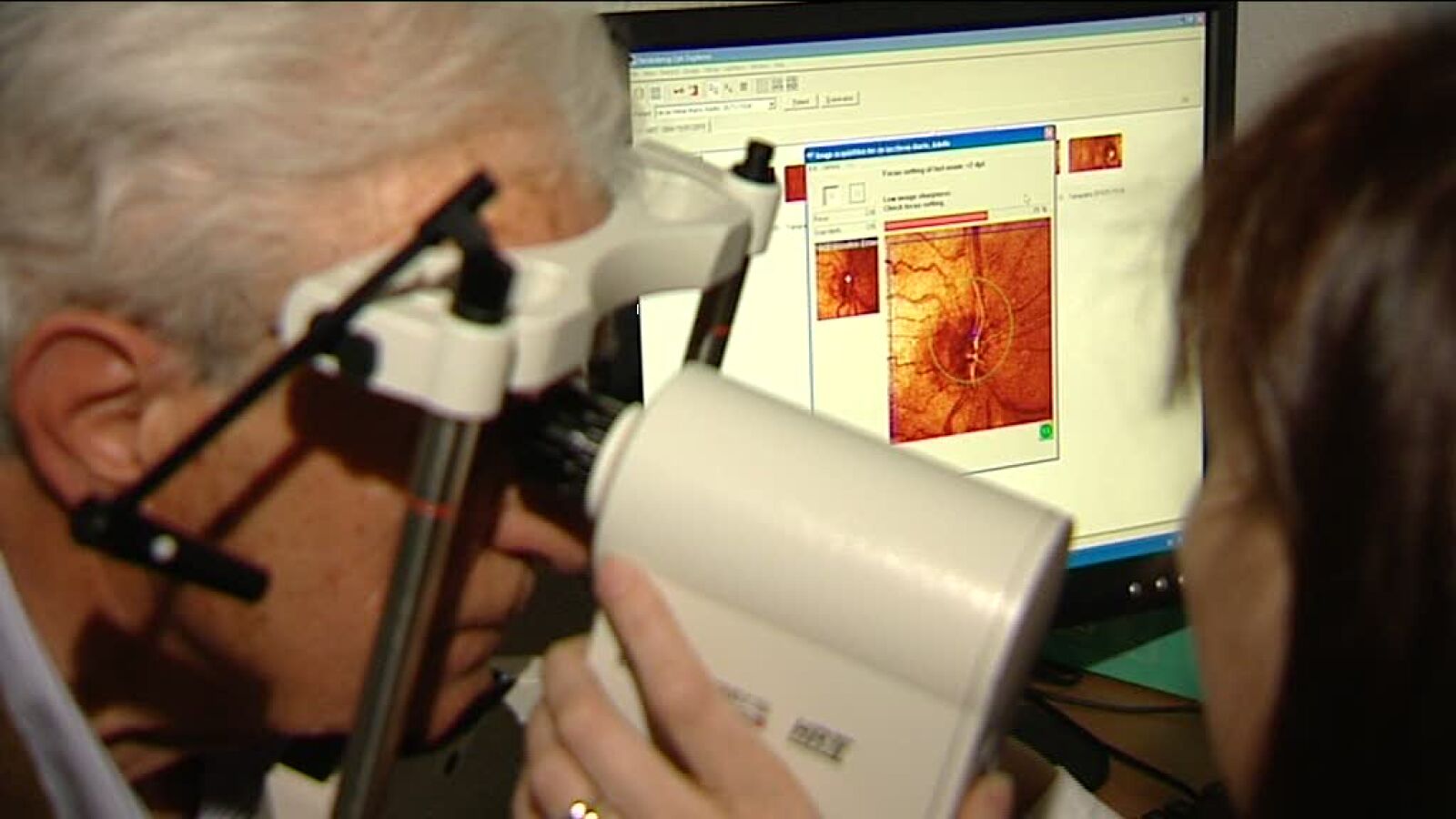El glaucoma o la ceguera silenciosa afecta a un millón de españoles